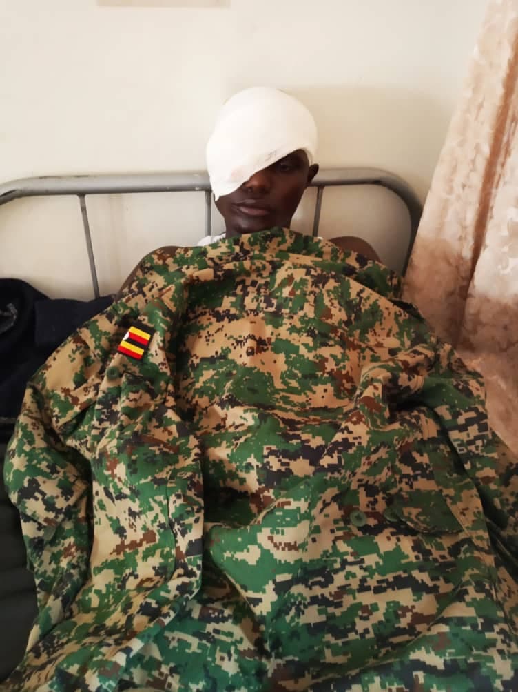 Attacks on Security Forces Must Stop, UPDF Warns as Soldier Loses Eye in Civilian Attack
