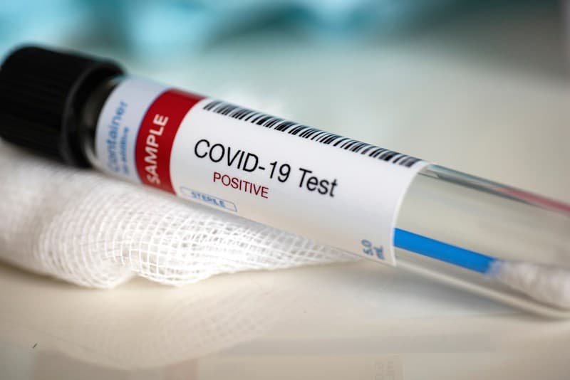 Uganda Registers Biggest Single-Day Jump in COVID-19 Cases Since Outbreak