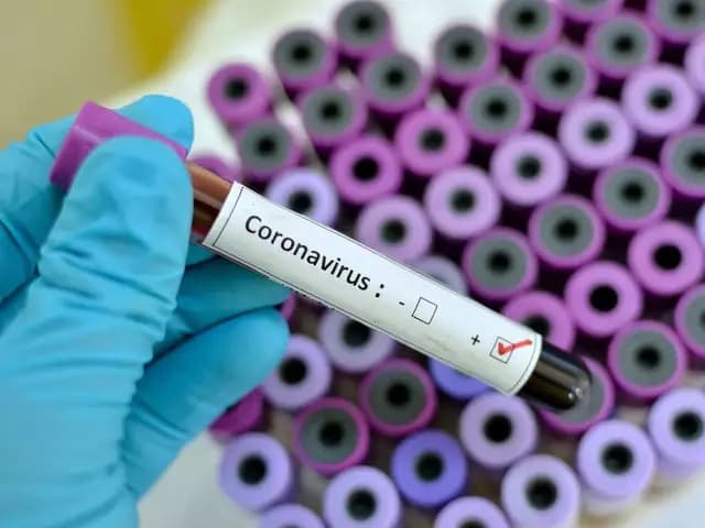 Uganda Registers New COVID-19 Death as Cases Soar to 1,656
