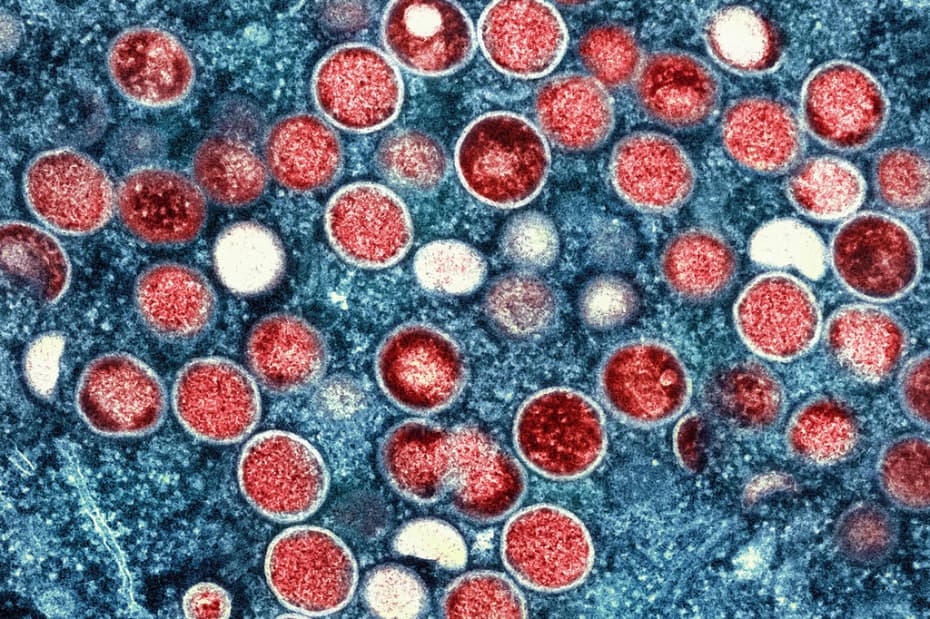 UNICEF Issues Urgent Appeal to Combat Mpox Outbreak in Africa