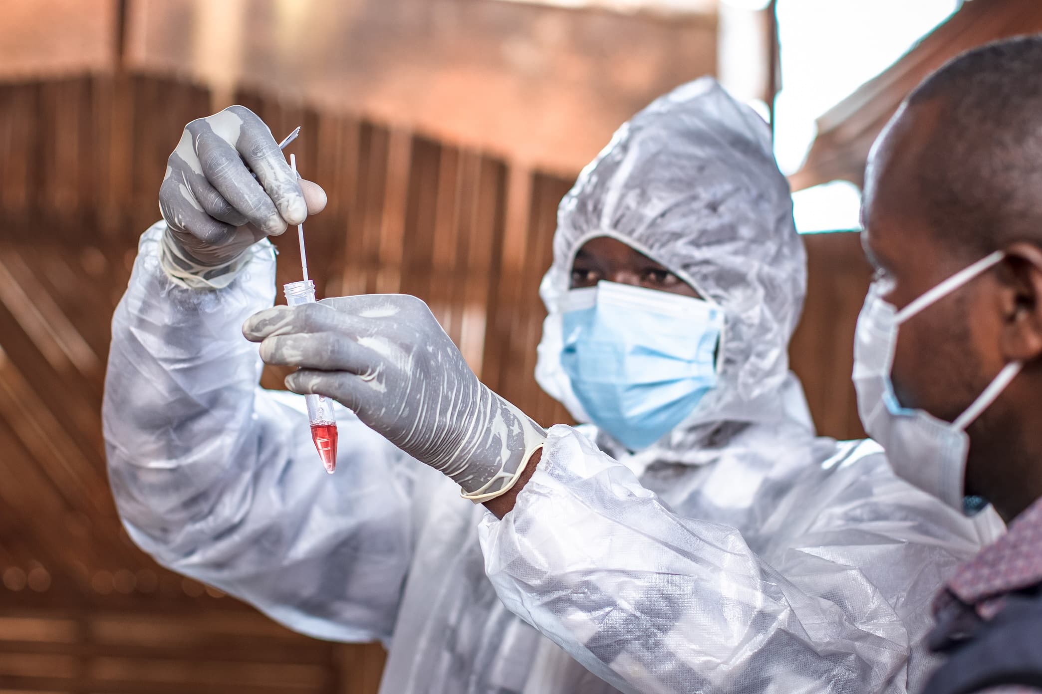 Uganda Intensifies Mpox Vaccination as Cases Rise in Kampala